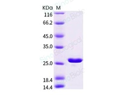 Sino Biological Recombinant Schistosoma japonicum GST Protein, Quantity: