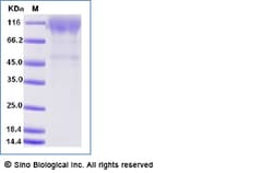 Sino Biological Recombinant Human CD96 Protein (His Tag), Amine-Labeled