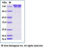 Sino Biological Recombinant Human CD68 Protein (ECD, hFc Tag), Quantity: