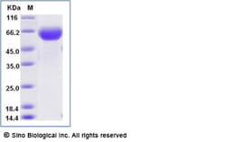Sino Biological Recombinant Human B7-H3 Protein (ECD, His & AVI Tag), Biotinylated,