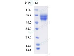 Sino Biological Recombinant Human IL-18Rα Protein (ECD, His Tag), HPLC-verified,