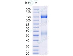 Sino Biological Human Insulin Receptor Protein (short isoform, His & AVI
