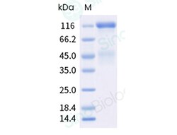 Sino Biological Recombinant Human Insulin Receptor Protein (isoform long,