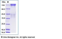 Sino Biological Recombinant Human Insulin Receptor Protein (long isoform,