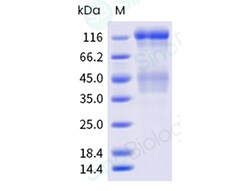 Sino Biological Recombinant Human Insulin Receptor Protein (ECD, long isoform,