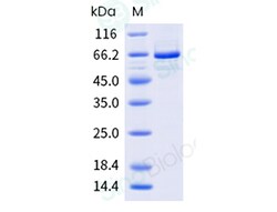 Sino Biological Recombinant Human PRMT5 Protein (His & FLAG Tag), Quantity:
