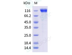 Sino Biological Recombinant Human TrkA Protein (ECD, hFc & AVI Tag), Biotinylated,