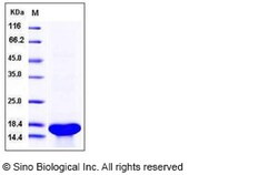 Sino Biological Recombinant Human TrkA Protein (aa 285-413, His Tag), Quantity: