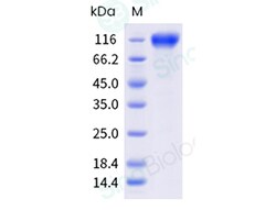 Sino Biological Recombinant Human TrkA Protein (ECD, hFc Tag), HPLC-verified,