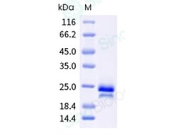 Sino Biological VEGF165 Protein, Human, Cynomolgus, Recombinant, HPLC-verified,