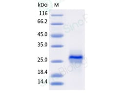Sino Biological VEGF165 Protein, Human, Recombinant (His & AVI Tag), Biotinylated,