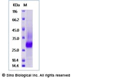 Sino Biological Recombinant Human Podoplanin Protein (His Tag), HPLC-verified,