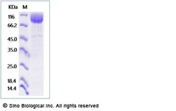 Sino Biological Recombinant Human LIMPII/SR-B2 Protein (hFc Tag), HPLC-verified,