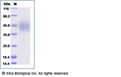 Sino Biological Recombinant Human CD16b/FCGR3B/Fc gamma RIIIB Protein (NA2 allotype,