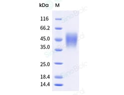 Sino Biological Recombinant Human CD16b/FCGR3B/Fc gamma RIIIB Protein (NA2 allotype,