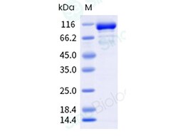 Sino Biological Recombinant Human PARP-1 Protein (His & AVI Tag), Biotinylated,