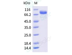 Sino Biological Recombinant Human N-Cadherin Protein (His Tag), Quantity: