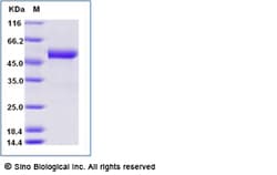 Sino Biological Recombinant Human CD5 Protein (ECD, His & AVI Tag), Biotinylated,