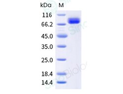 Sino Biological Recombinant Human Transferrin Protein, HPLC-verified, Quantity: