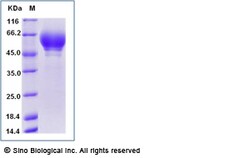 Sino Biological Recombinant Human Cortisol Binding Globulin/CBG Protein