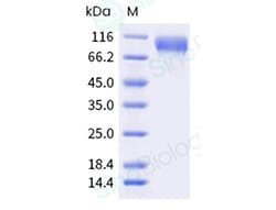 Sino Biological Recombinant Human C1 inhibitor/C1-INH Protein (His Tag),