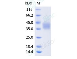 Sino Biological Recombinant Human NKp80/KLRF1 Protein (His Tag), HPLC-verified,