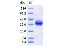 Sino Biological Recombinant Human CD2 Protein (ECD, His Tag), HPLC-verified,