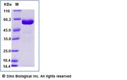 Sino Biological Recombinant Human CD2 Protein (ECD, hFc Tag), HPLC-verified,