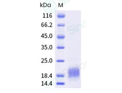 Sino Biological Recombinant Human CD3 epsilon/CD3e Protein (His Tag), HPLC-verified,