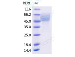 Sino Biological Recombinant Human IL-7R alpha/CD127 Protein (ECD, His Tag),