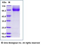 Sino Biological Recombinant Human IL-7R alpha/CD127 Protein (ECD, hFc Tag),