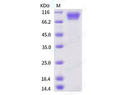 Sino Biological Recombinant Human gp130/IL6ST Protein, HPLC-verified, Quantity: