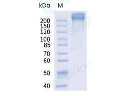 Sino Biological Recombinant Human Von Willebrand Factor/vWF Protein (His
