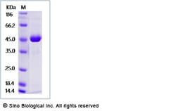 Sino Biological Recombinant Human Renin Protein (66R/K, His Tag), Quantity: