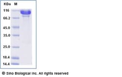 Sino Biological Recombinant Human alanyl-tRNA synthetase Protein (His Tag),