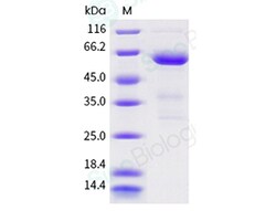 Sino Biological Recombinant Human 5'-nucleotidase/CD73/NT5E Protein (His