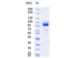 Sino Biological Recombinant Human 5'-nucleotidase/CD73/NT5E Protein (hFc