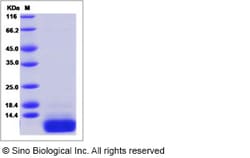 Sino Biological Recombinant Human CCL5/RANTES Protein, Quantity: Each of