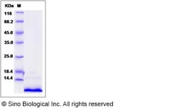 Sino Biological Recombinant Human CXCL5 Protein, Quantity: Each of 1