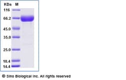 Sino Biological Recombinant Human CD200 Protein (ECD, hFc & AVI Tag), Biotinylated,
