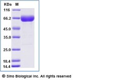 Sino Biological Recombinant Human CD200 Protein (ECD, hFc & AVI Tag), Biotinylated,