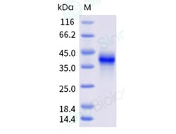 Sino Biological Recombinant Human TNFR1/CD120a Protein (His & AVI Tag),