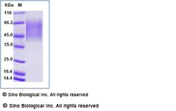 Sino Biological Recombinant Human CEACAM-6/CD66c Protein (His Tag), HPLC-verified,
