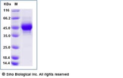 Sino Biological Recombinant Human CD38 Protein (ECD, His & AVI Tag), Biotinylated,