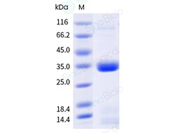 Sino Biological Human Apolipoprotein E Protein (C130R, Isoform E4), Quantity: