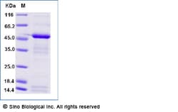 Sino Biological Recombinant Human Apolipoprotein E/APOE Protein (isoform