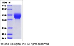 Sino Biological Recombinant Human TGF beta 1 Protein (LAP, His Tag), Quantity: