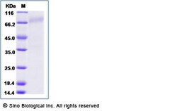 Sino Biological Recombinant Human CD30/TNFRSF8 Protein (His Tag), Amine-Labeled