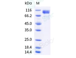 Sino Biological Recombinant Human CD30/TNFRSF8 Protein (ECD, hFc Tag),