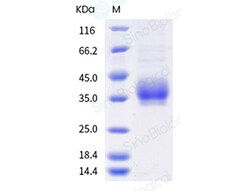 Sino Biological Recombinant Human ANGPTL3/Angiopoietin-like 3 Protein (His